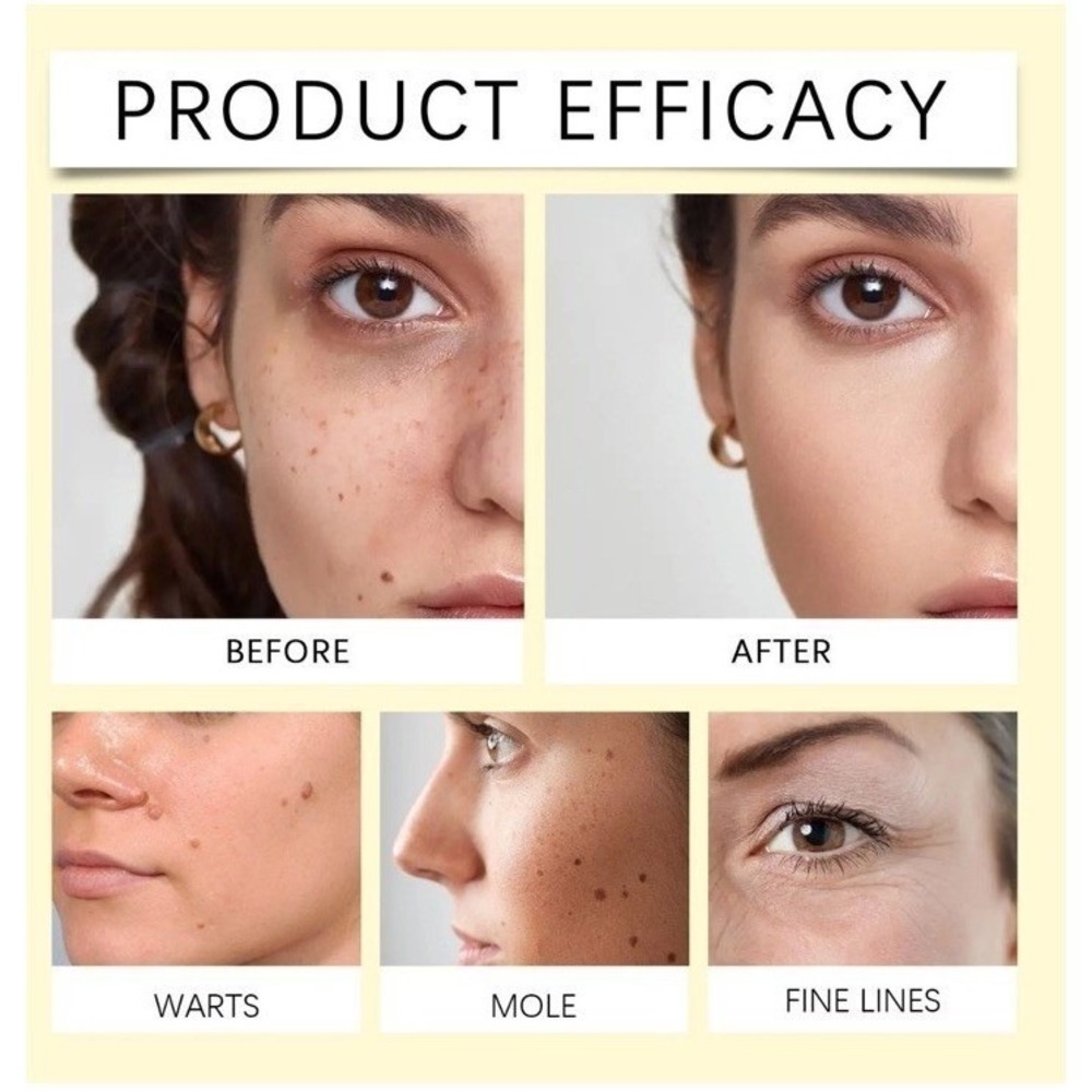 Bee Venom Skin Restoration Cream, Professional Bee Venom Skin Treatment Cream - Picture 4 of 9